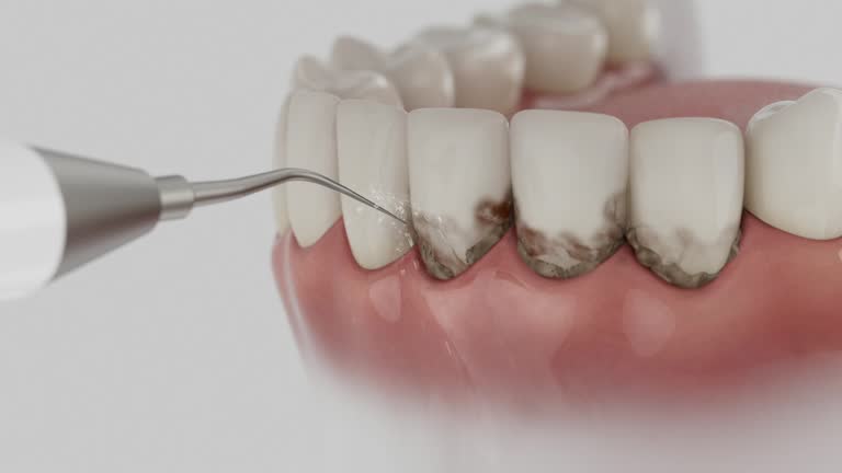 Trusted Teeth Cleaning And Checkup service in Ralston, NE - Dentist Open Now